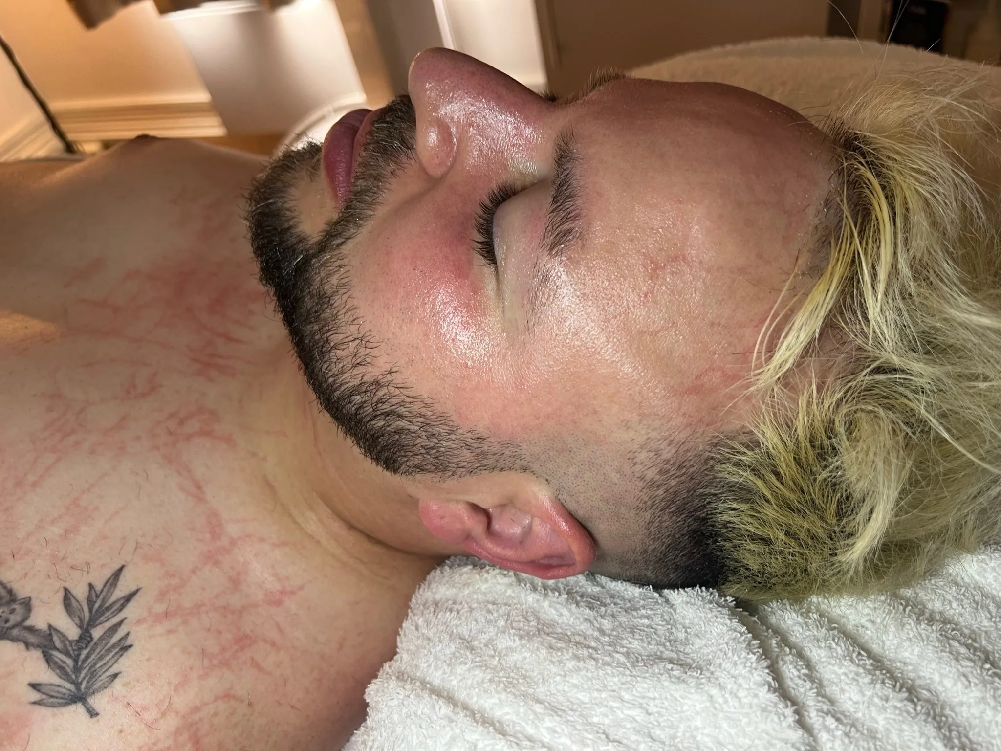 Client relaxing mid-facial treatment at Richmond Skin and Laser Clinic